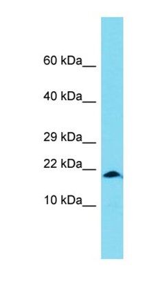 XAGE1B antibody