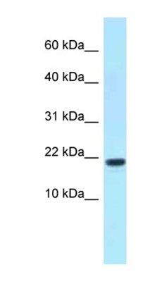 XAGE1D antibody