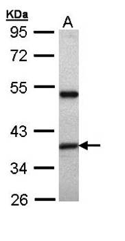 XAP2 antibody