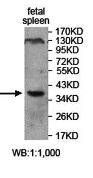 XCR1 Rabbit Polyclonal Antibody