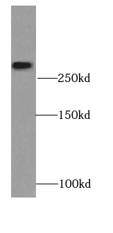 XIRP2 antibody