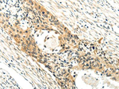XK Antibody