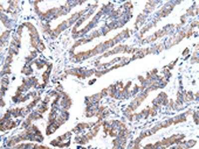 XKR4 antibody