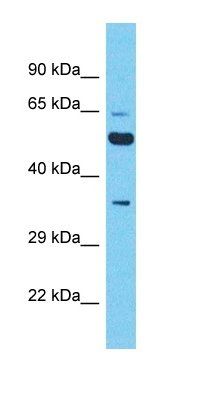 XKR5 antibody