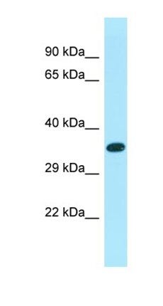XKR6 antibody