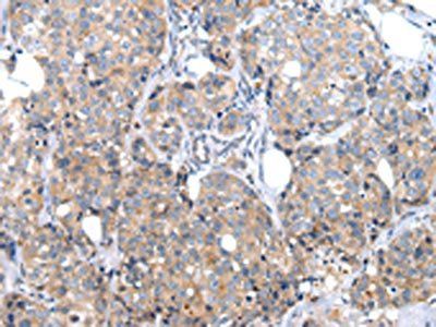 XKRX Antibody