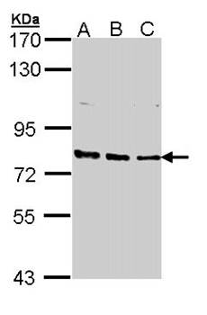 XPB antibody