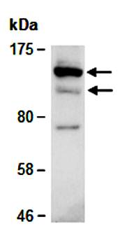 XPC antibody