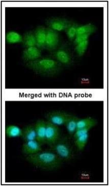 XPNPEP3 antibody [N1C3]