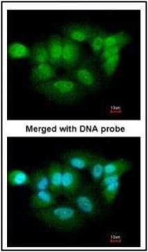 XPNPEP3 antibody