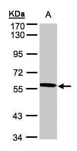 XPNPEP3 Rabbit Polyclonal Antibody