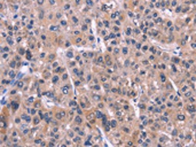 XPO1 Antibody