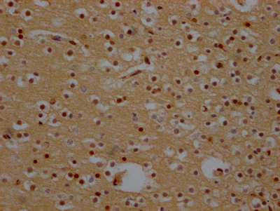 XPO1 Recombinant Monoclonal Antibody