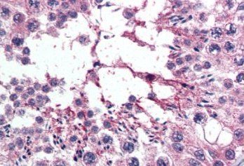 Goat anti-RANBP16 / Exportin 7 Antibody