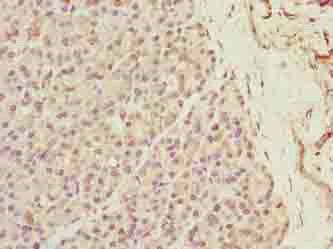 XPR1 Antibody