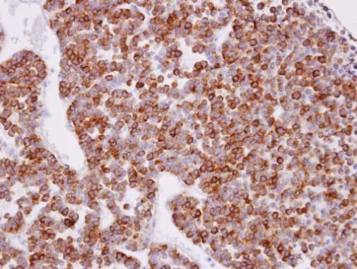 XPR1 antibody [N1], N-term