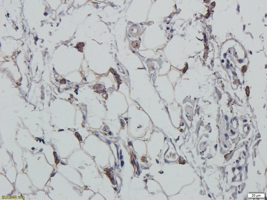 XRCC1 antibody