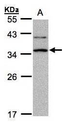 XRCC2 Rabbit Polyclonal Antibody