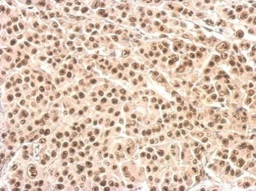 XRCC4 Rabbit Polyclonal Antibody