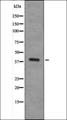 XRCC4 (Phospho-Ser260) antibody