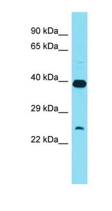XRCC6BP1 antibody