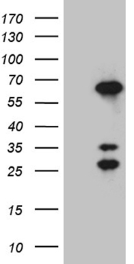 XRN2 antibody