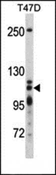 XRN2 antibody