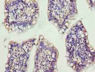 XRRA1 Antibody