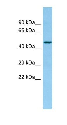 Xxylt1 antibody