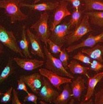 Y14 Monoclonal Antibody [4C4] - Unconjugated / 0.1ml