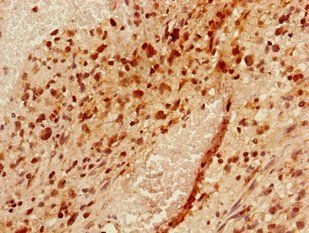 YAF2 Antibody