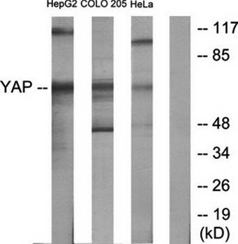 YAP antibody