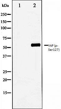 YAP (phospho-Ser127) antibody