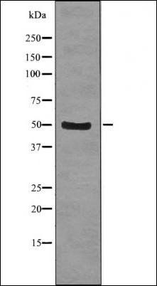 YB1 (Phospho-Ser102) antibody