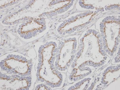 YIPF4 Rabbit Polyclonal Antibody