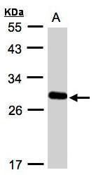 YIPF4 Rabbit Polyclonal Antibody