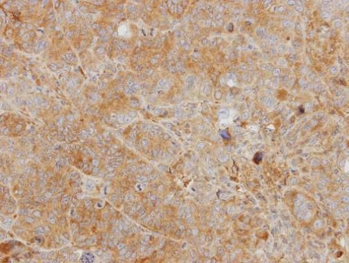 YKL-39 Rabbit Polyclonal Antibody