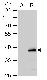 YKL-39 Rabbit Polyclonal Antibody