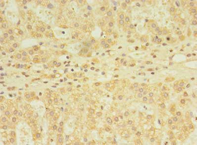 YKT6 Antibody