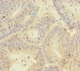 YME1L1 antibody