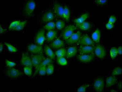 YOD1 Antibody