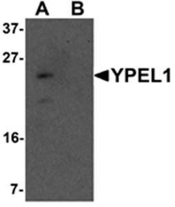 YPEL1 Antibody