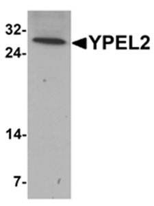 YPEL2 Antibody