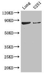 YTHDC1 Antibody