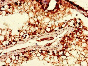 YTHDF2 antibody