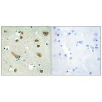YWHAG Antibody