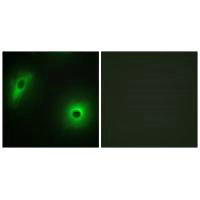 YWHAH Antibody