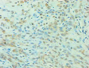 YWHAQ Antibody