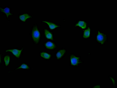 YWHAZ Monoclonal Antibody