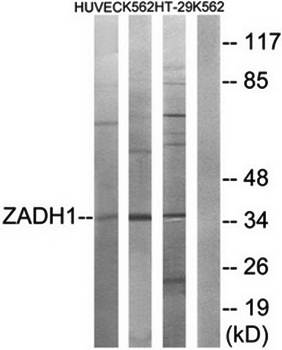ZADH1 antibody